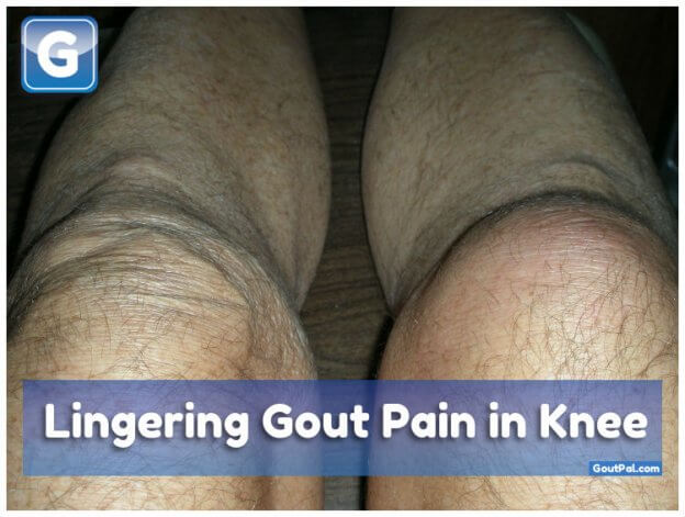 Lingering Gout Pain in Knee