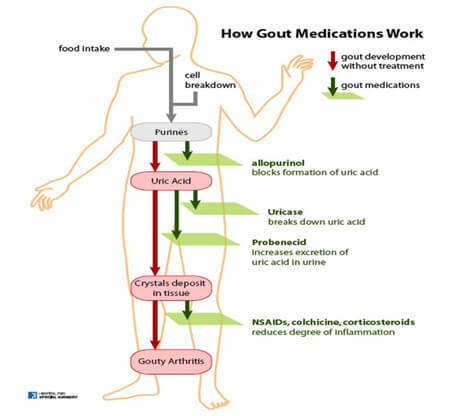 How Gout Medications Work media
