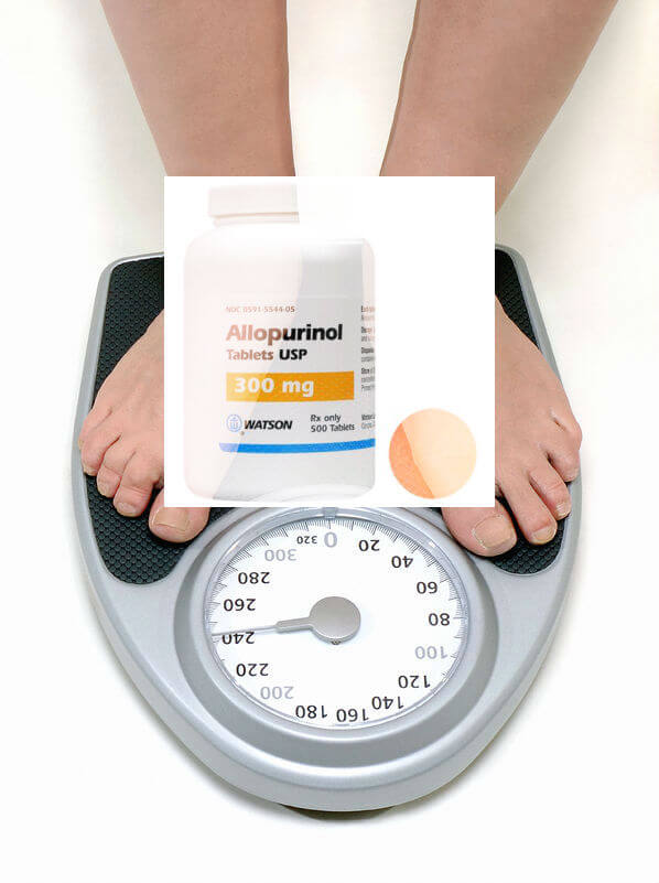 Does Allopurinol make you Gain Weight?