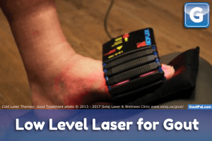 Low Level Gout Laser Therapy