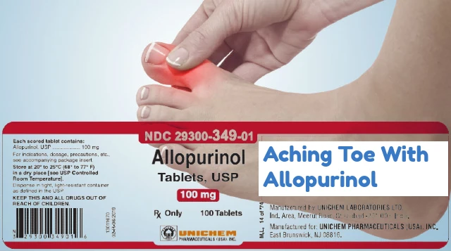 Aching Toe with Allopurinol