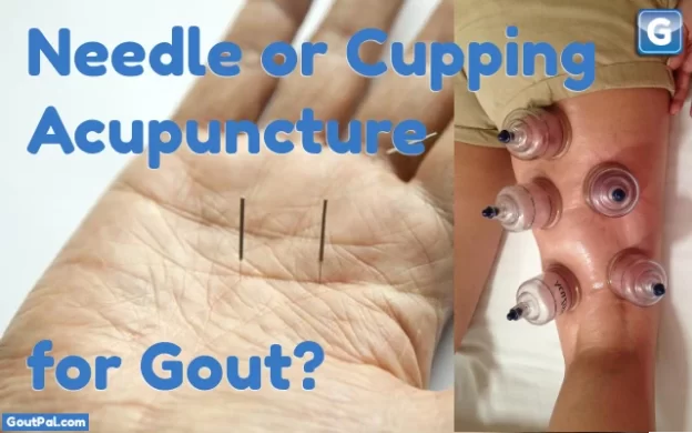 Needle or Cupping Acupuncture for Gout?